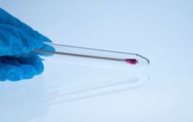 SANITA’, Individuato il Dna del papilloma virus nel sangue di donne senza tumore