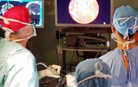 SANITA’, Al Brotzu intervento sul cervello attraverso il naso con endoscopio 3D di ultima generazione